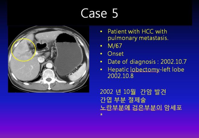 %ea%b0%84%ea%b2%bd%ed%99%94-001