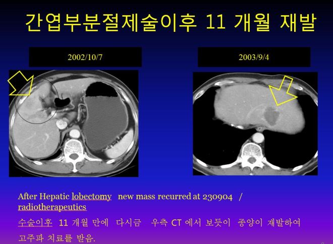 %ea%b0%84%ea%b2%bd%ed%99%94-002