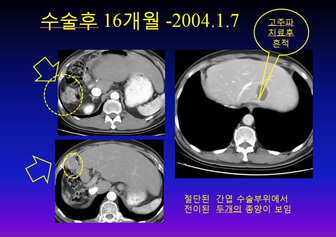 %ea%b0%84%ea%b2%bd%ed%99%94-003