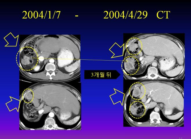 %ea%b0%84%ea%b2%bd%ed%99%94-004