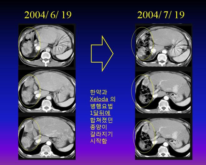 %ea%b0%84%ea%b2%bd%ed%99%94-008