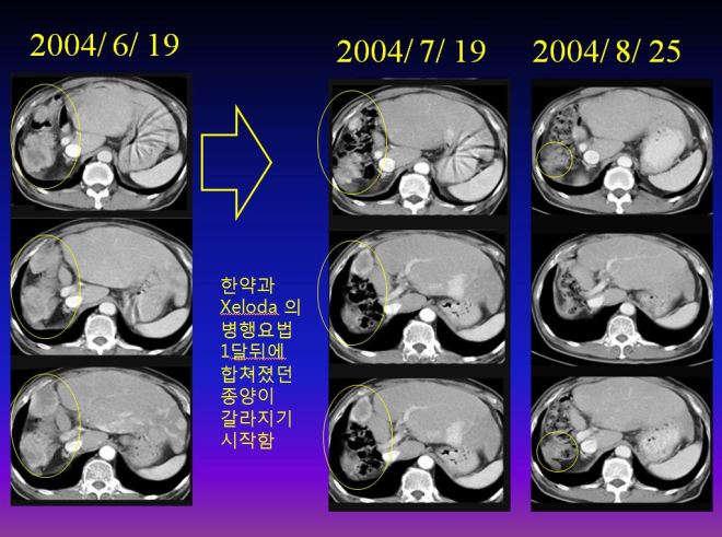 %ea%b0%84%ea%b2%bd%ed%99%94-009