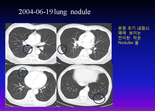 %ea%b0%84%ea%b2%bd%ed%99%94-010