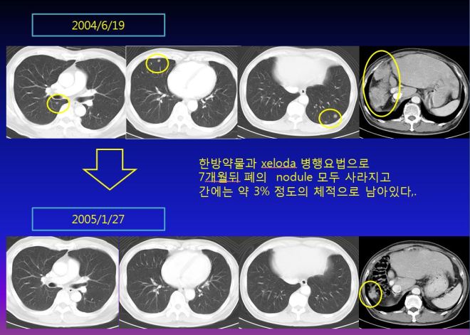 %ea%b0%84%ea%b2%bd%ed%99%94-011