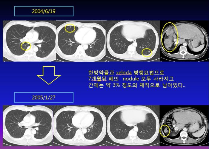 %ea%b0%84%ea%b2%bd%ed%99%94-011