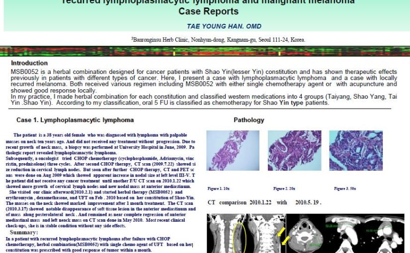 lymphoplasmacytic lymphoma  소음인 림프종환자의 case와 MSB0052&nbsp;본원항암약물