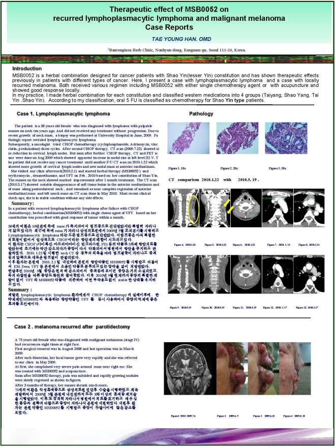 lymphoplasmacytic_lymphoma%eb%b2%88%ec%97%ad%eb%b3%b8