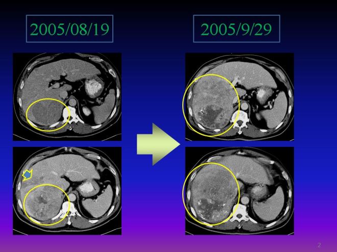 %ea%b0%84%ec%95%943-14