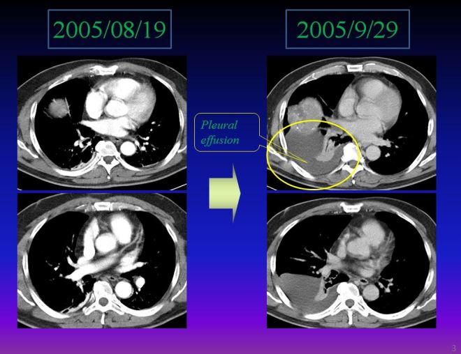 %ea%b0%84%ec%95%943-15