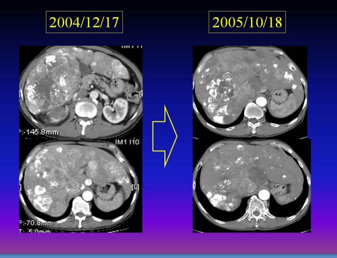 %ea%b0%84%ec%95%943-3