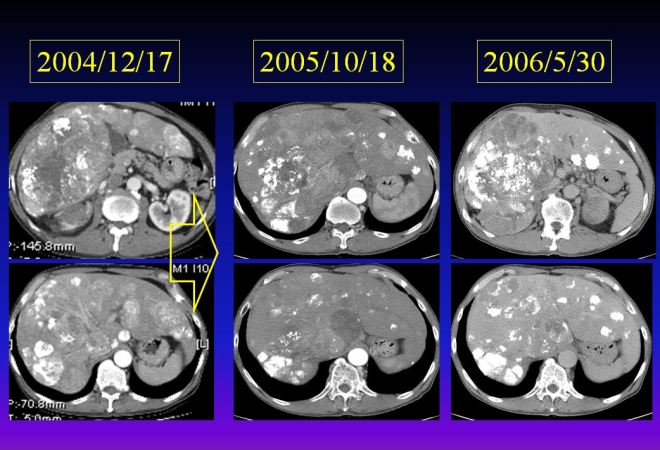 %ea%b0%84%ec%95%943-4