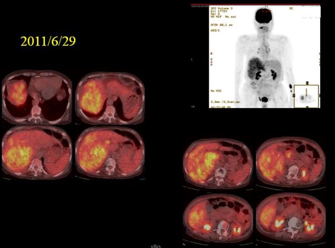 %eb%84%a5%ec%82%ac%eb%b0%941