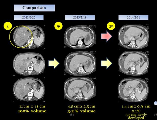 %eb%84%a5%ec%82%ac%eb%b0%943