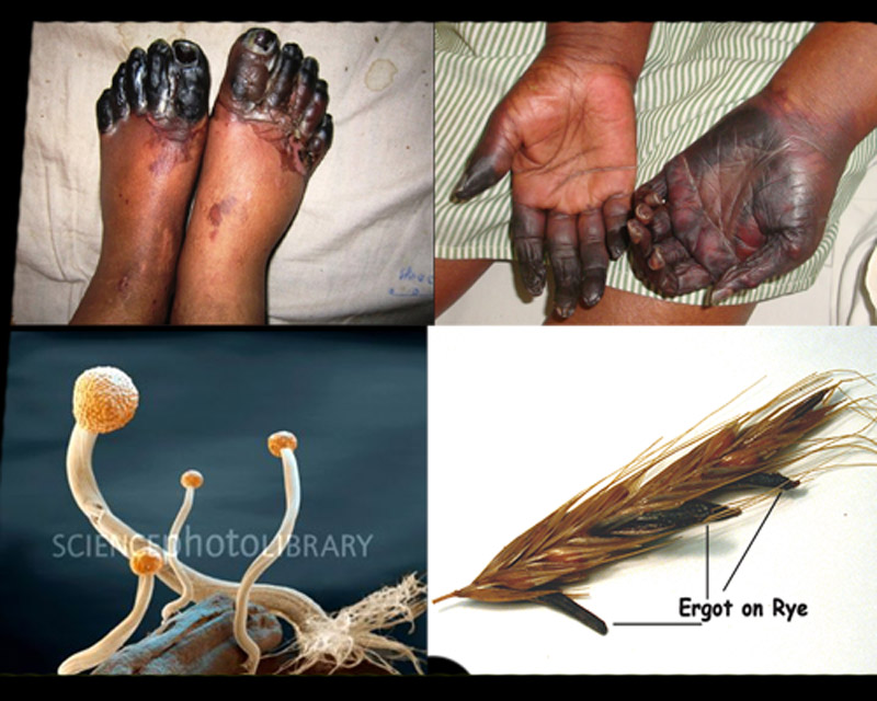 %ec%8b%b8%ec%9d%b4%ed%86%a0%ed%85%8d-14