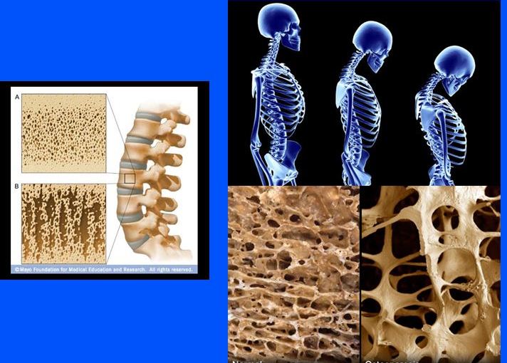 음양론- calcium과  phosphorus 인의&nbsp;상대성