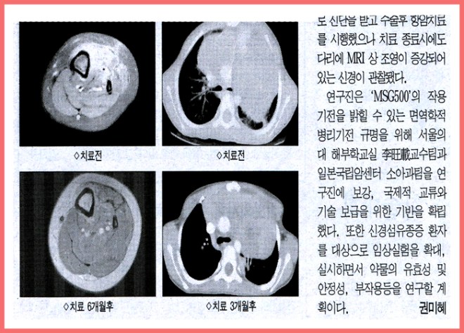서울대 2004 의협신문1-2.jpg