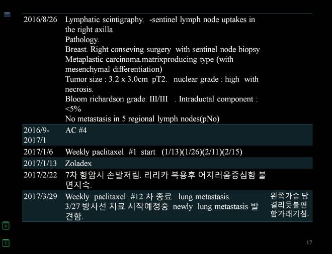 cancer 2017-07-005 전영옥 유방암1.jpg